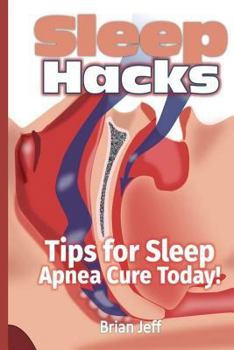 Paperback Sleep Hacks: Tips for Apnea Cure Today! Book