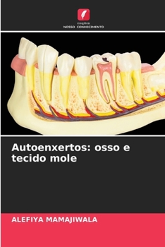 Paperback Autoenxertos: osso e tecido mole [Portuguese] Book