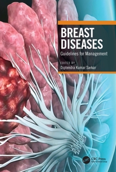 Paperback Breast Diseases: Guidelines for Management Book
