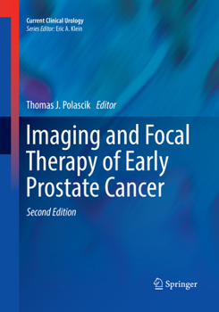 Paperback Imaging and Focal Therapy of Early Prostate Cancer Book