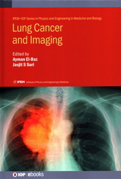 Hardcover Lung Cancer and Imaging Book