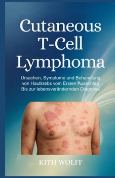 Cutaneous T-Cell Lymphoma: Ursachen, Symptome und Behandlung von Hautkrebs vom ersten Ausschlag bis zur lebensverändernden Diagnose (German Edition)