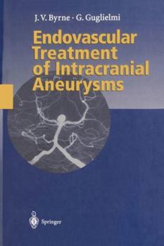 Paperback Endovascular Treatment of Intracranial Aneurysms Book