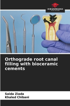 Paperback Orthograde root canal filling with bioceramic cements Book