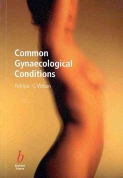 Paperback Common Gynaecological Problems Book
