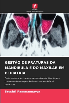 Paperback Gestão de Fraturas Da Mandíbula E Do Maxilar Em Pediatria (Portuguese Edition) [Portuguese] Book