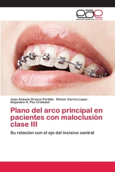 Plano del Arco Principal En Pacientes Con Maloclusion Clase III