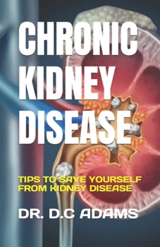 Paperback Chronic Kidney Disease: Tips to Save Yourself from Kidney Disease Book