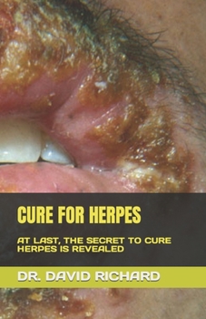 Paperback Cure for Herpes: At Last, the Secret to Cure Herpes Is Revealed Book