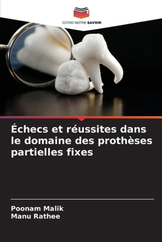 Échecs et réussites dans le domaine des prothèses partielles fixes (French Edition)