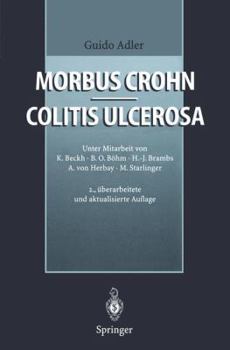 Paperback Morbus Crohn - Colitis Ulcerosa [German] Book