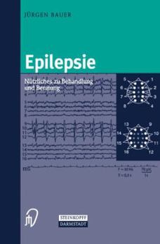 Paperback Epilepsie: Nützliches Zu Behandlung Und Beratung [German] Book