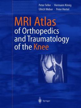 Paperback MRI Atlas of Orthopedics and Traumatology of the Knee Book
