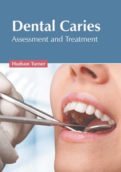 Hardcover Dental Caries: Assessment and Treatment Book