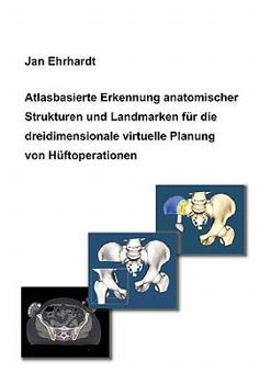 Paperback Atlasbasierte Erkennung anatomischer Strukturen und Landmarken für die dreidimensionale virtuelle Planung von Hüftoperationen [German] Book