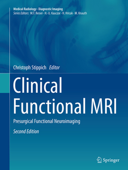 Paperback Clinical Functional MRI: Presurgical Functional Neuroimaging Book