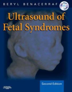 Hardcover Ultrasound of Fetal Syndromes: Text with DVD [With DVD] Book