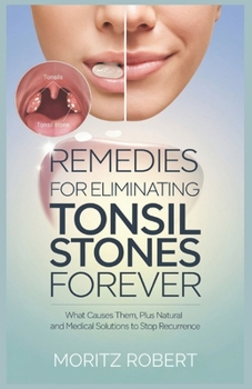 Paperback Remedies for Eliminating Tonsil Stones Forever: What Causes Them, Plus Natural and Medical Solutions to Prevent Recurrence Book