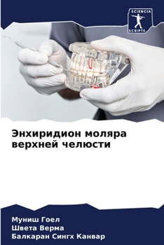 Paperback Энхиридион моляра верхн& [Russian] Book