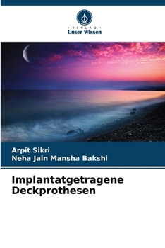 Paperback Implantatgetragene Deckprothesen [German] Book