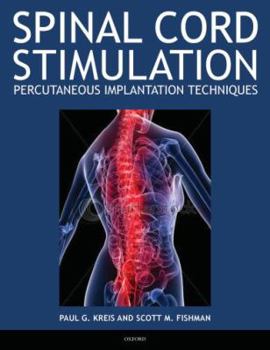 Paperback Spinal Cord Stimulation: Percutaneous Implantation Techniques Book