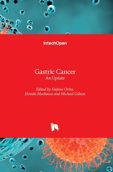 Hardcover Gastric Cancer: An Update Book
