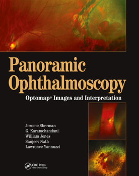 Hardcover Panoramic Ophthalmoscopy: Optomap Images and Interpretation Book