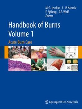 Hardcover Handbook of Burns, Volume 1: Acute Burn Care Book