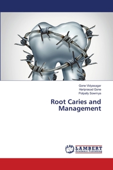 Paperback Root Caries and Management Book