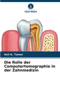 Paperback Die Rolle der Computertomographie in der Zahnmedizin [German] Book