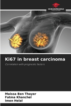 Paperback Ki67 in breast carcinoma Book