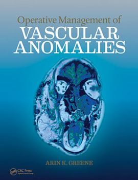 Hardcover Operative Management of Vascular Anomalies Book