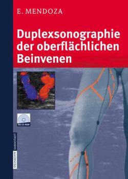 Paperback Duplexsonographie Der Oberflächlichen Beinvenen [German] Book