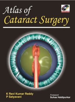 Atlas of Cataract Surgery