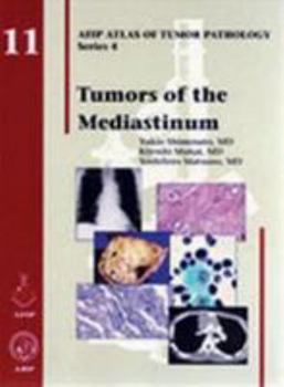 Hardcover Tumors of the Mediastinum Book