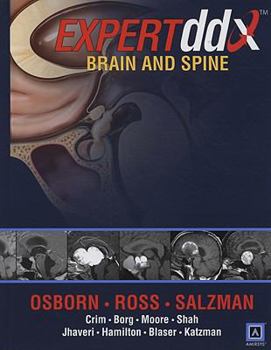 Hardcover Brain and Spine Book