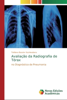 Paperback Avaliação da Radiografia de Tórax [Portuguese] Book