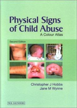Hardcover Physical Signs of Child Abuse, 2nd Edition Book