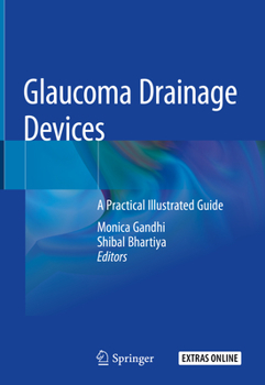 Hardcover Glaucoma Drainage Devices: A Practical Illustrated Guide Book