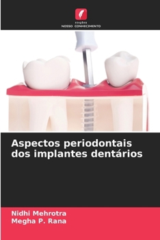 Paperback Aspectos periodontais dos implantes dentários [Portuguese] Book