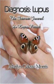 Paperback Diagnosis: Lupus: The Intimate Journal of a Lupus Patient Book