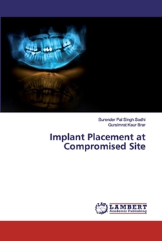 Paperback Implant Placement at Compromised Site Book