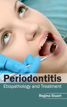 Hardcover Periodontitis: Etiopathology and Treatment Book
