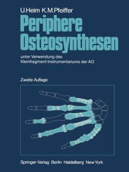 Paperback Periphere Osteosynthesen: Unter Verwendung Des Kleinfragment-Instrumentariums Der Ao [German] Book