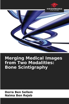Paperback Merging Medical Images from Two Modalities: Bone Scintigraphy Book