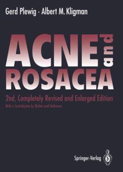 Hardcover ACNE and ROSACEA Book