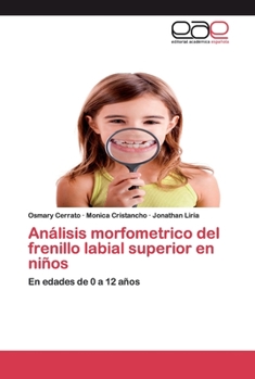 Paperback Análisis morfometrico del frenillo labial superior en niños [Spanish] Book