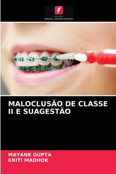 Paperback Maloclusão de Classe II E Suagestão [Portuguese] Book