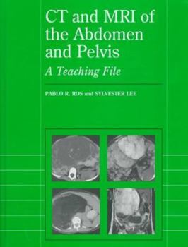 Hardcover CT and MRI of the Abdomen and Pelvis: A Teaching File Book