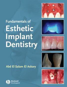 Hardcover Fundamentals of Esthetic Implant Dentistry Book